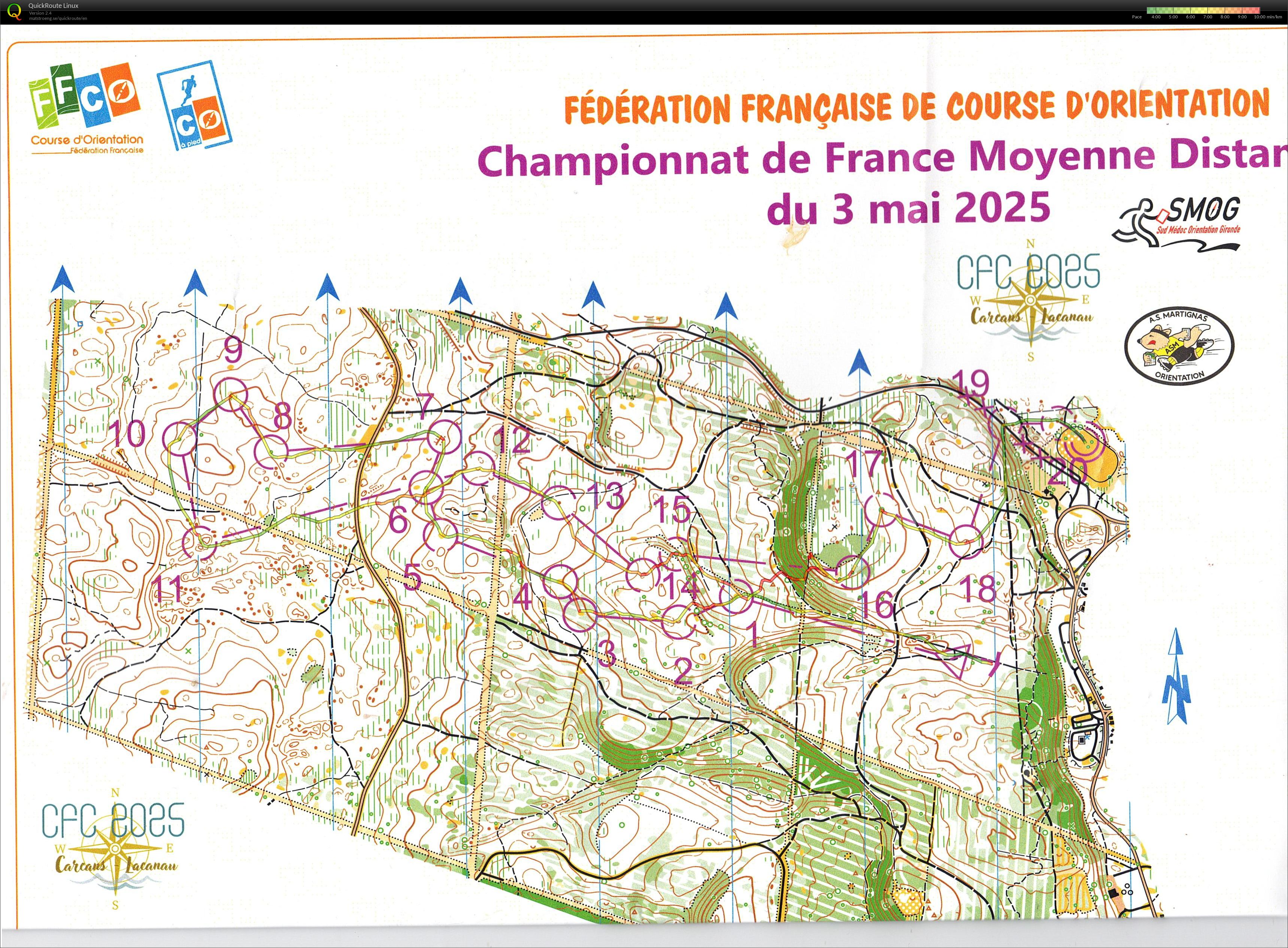 Chpt de Fr MD (03-05-2025)